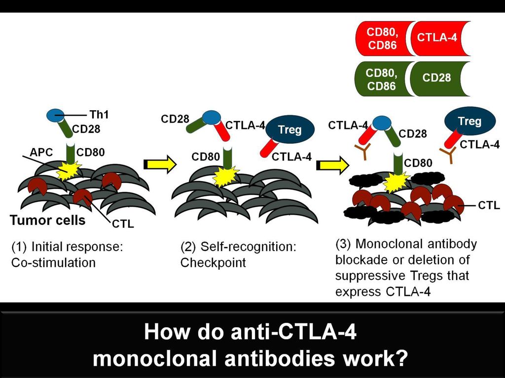 CTLA-4 is a protein expressed on the surface of T cells that binds to a ligand on APCs, as well as other cells.[11] Ligation of CTLA-4 will impair the function of the T-cell receptor (TCR) and inhibit signaling that would activate the T cells. CTLA-4 engages early in the process of T-cell activation and limits the magnitude of the immune response. Blocking CTLA-4 with monoclonal antibodies has resulted in durable clinical responses in metastatic melanoma. Ipilimumab (anti-CTLA-4 antibody) is a US FDA-approved therapy for this disease and the first to show survival benefit.[12,13]