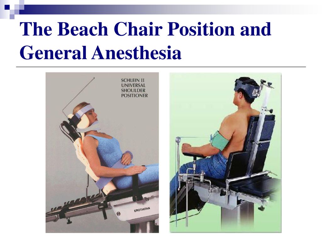 The Beach Chair Position And General Anesthesia Ppt Download