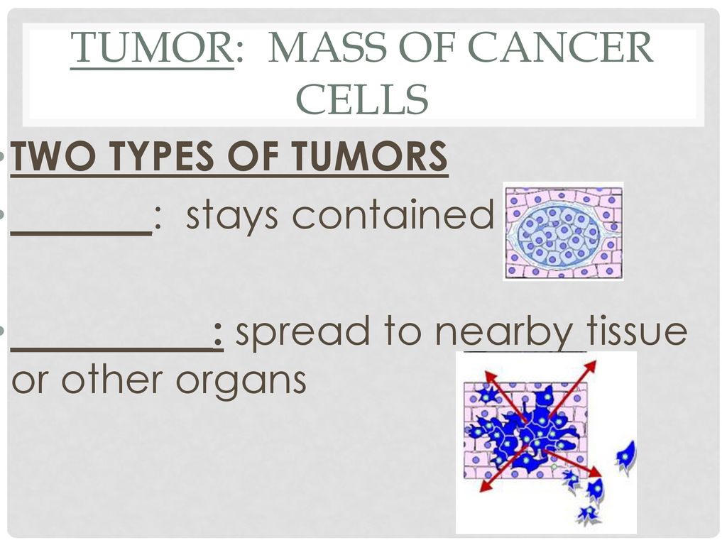 Tumor: MASS OF CANCER CELLS