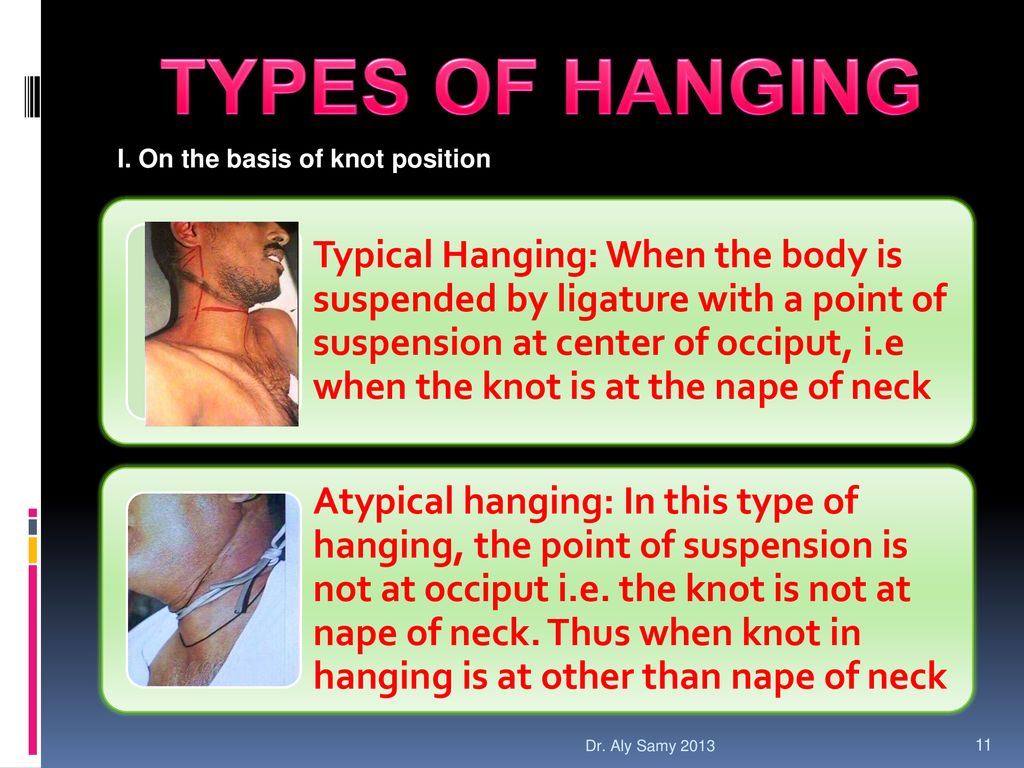 What is typical hanging?