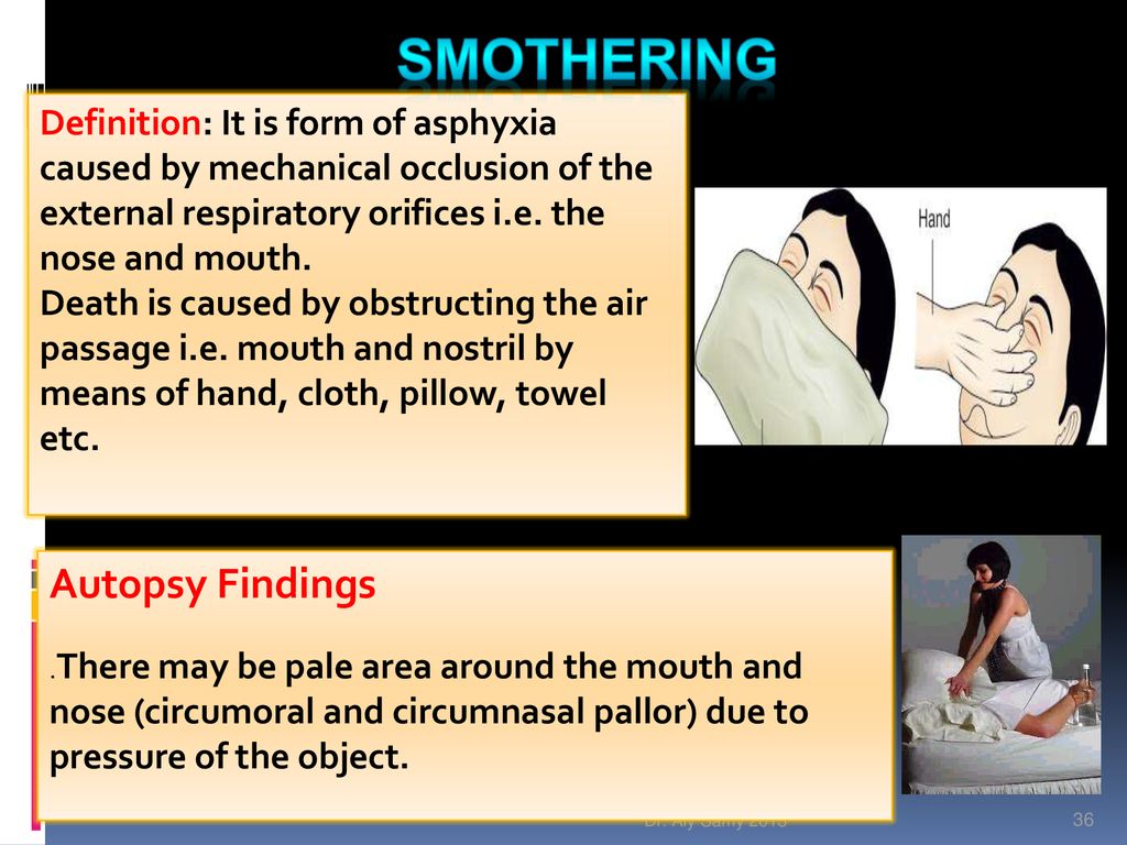 Smother vs Asphyxiation: Meaning And Differences