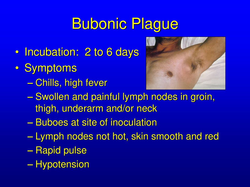 bubonic plague symptoms buboes