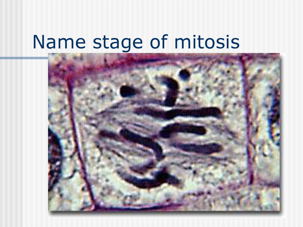 Name stage of mitosis 27