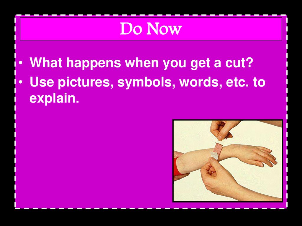 Do Now What happens when you get a cut