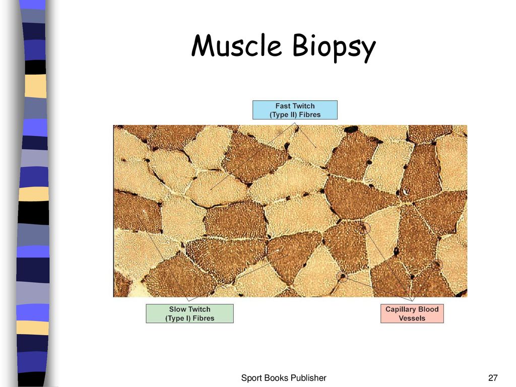 Muscle Biopsy Sport Books Publisher