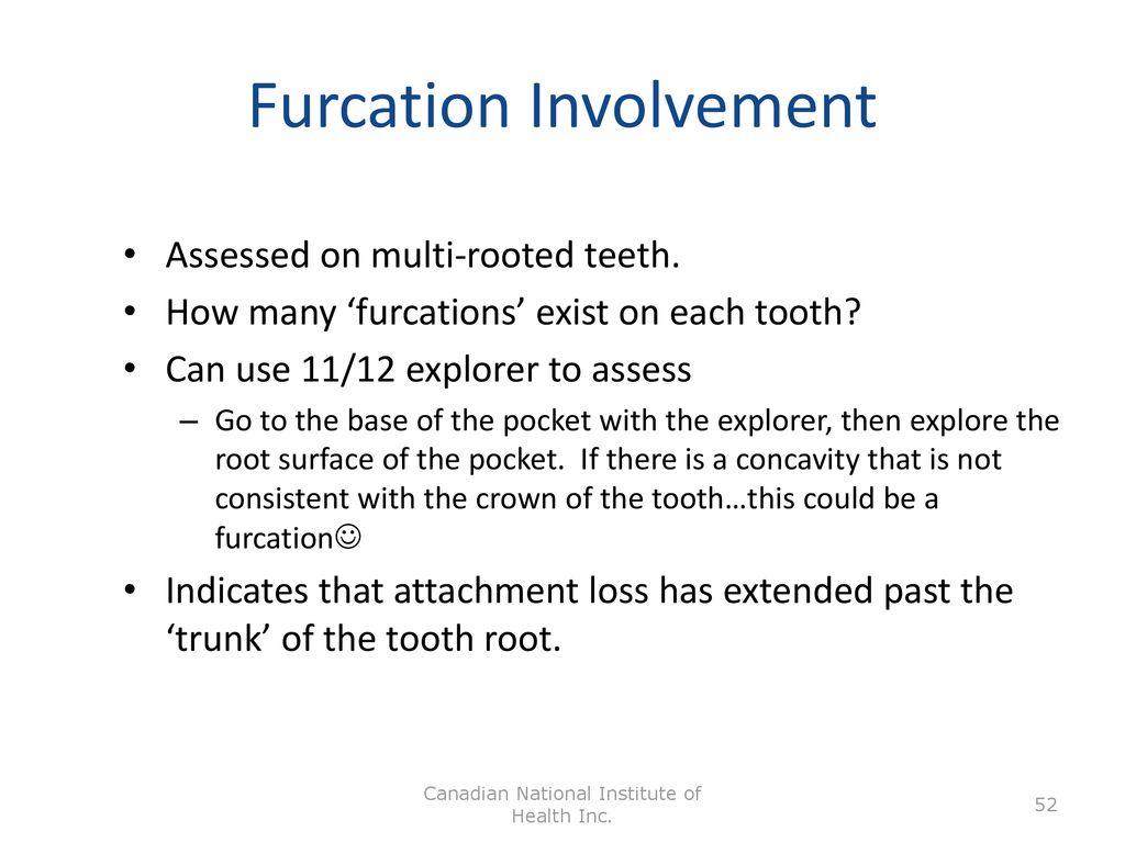 Periodontics Dh 240 Weeks 3 4 Clinical Periodontal Assessment Ppt Download Periodontics Dh 240 Weeks 3 4 Clinical Periodontal Assessment Ppt Download