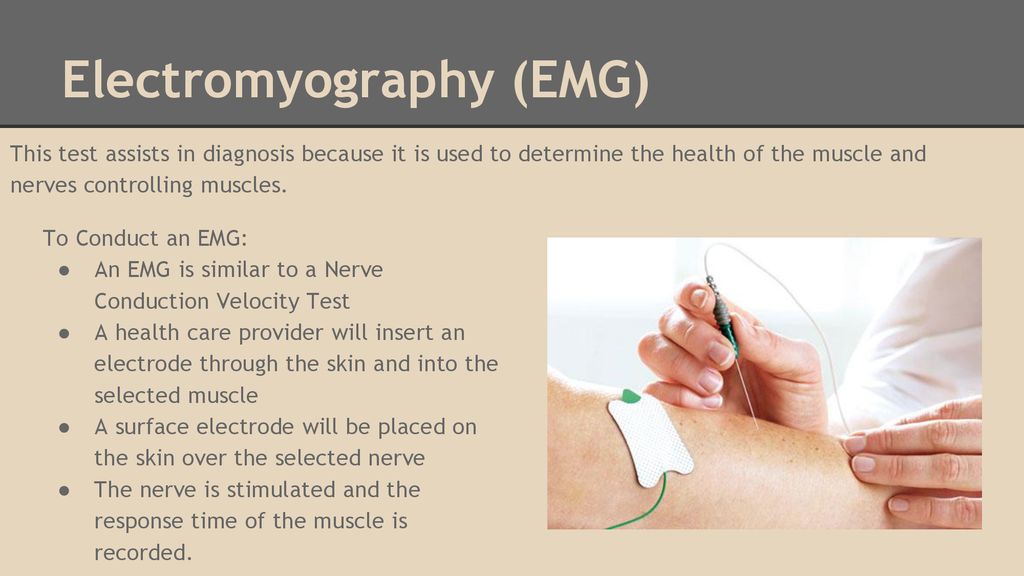 Electromyography (EMG)
