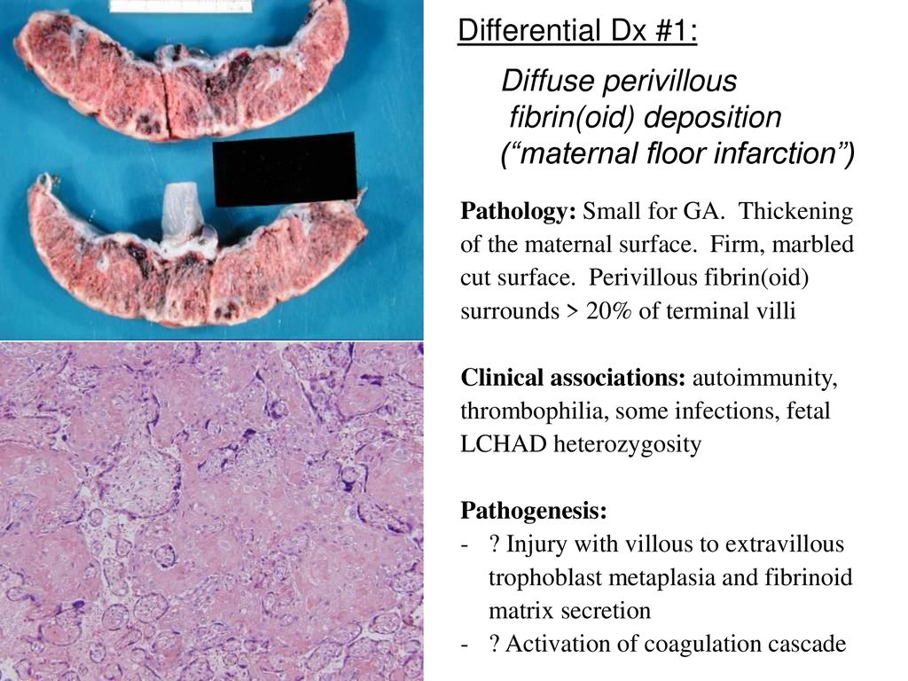Providing Clinically Relevant Placental Diagnoses In Ppt Download