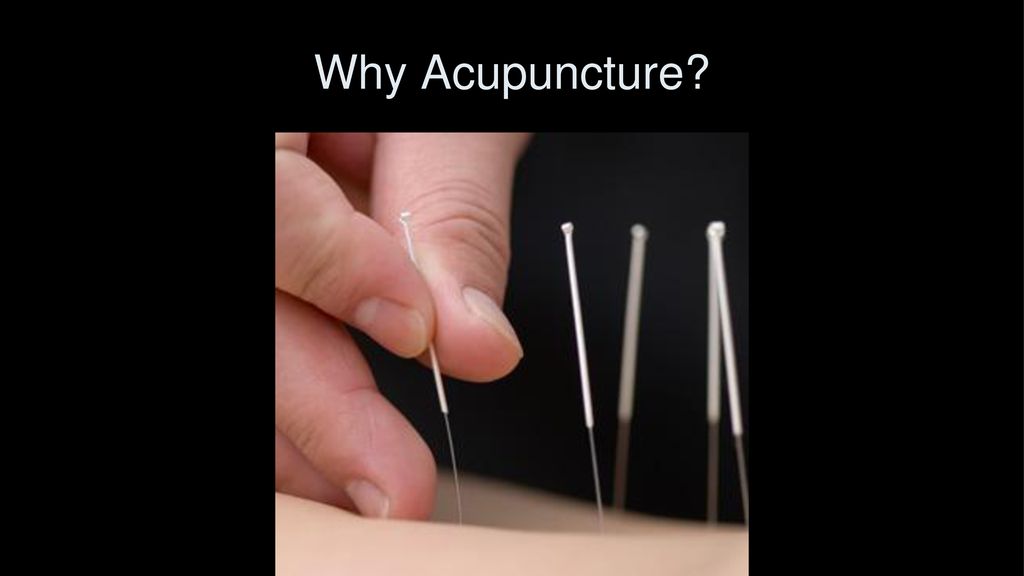 Why Acupuncture