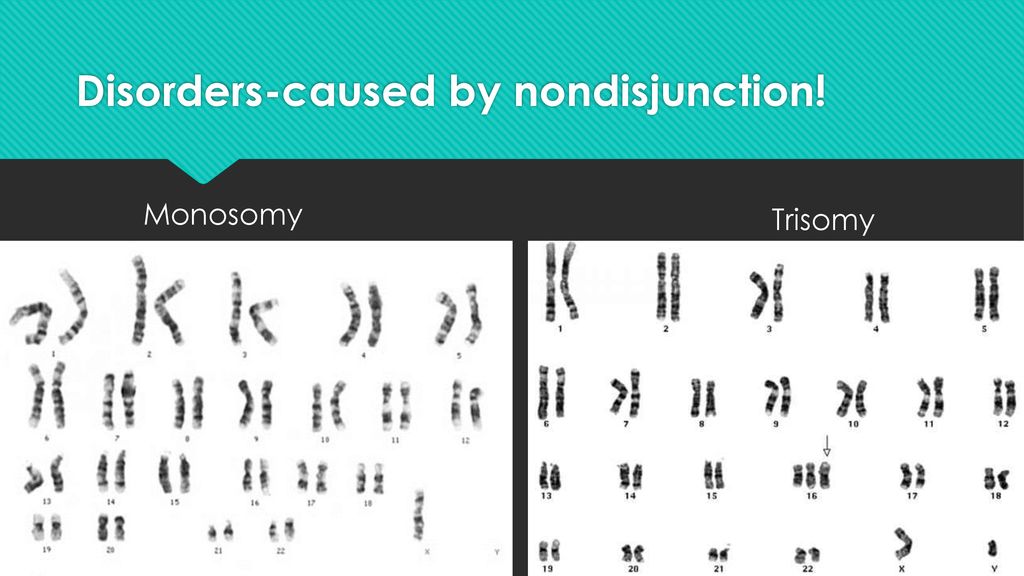 Chromosomal Mutations & Karyotypes - ppt download