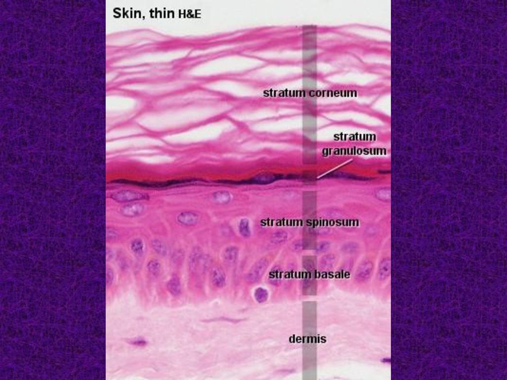 Skin Thin All epidermis layers