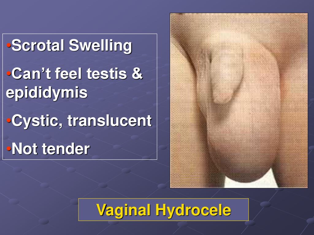 Tender Vagina