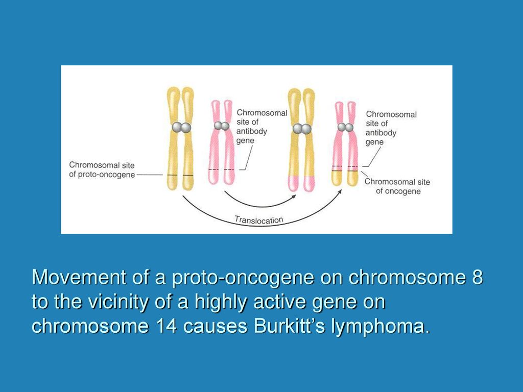 Movement of a proto-oncogene on chromosome 8 to the vicinity of a highly active gene on chromosome 14 causes Burkitt’s lymphoma.