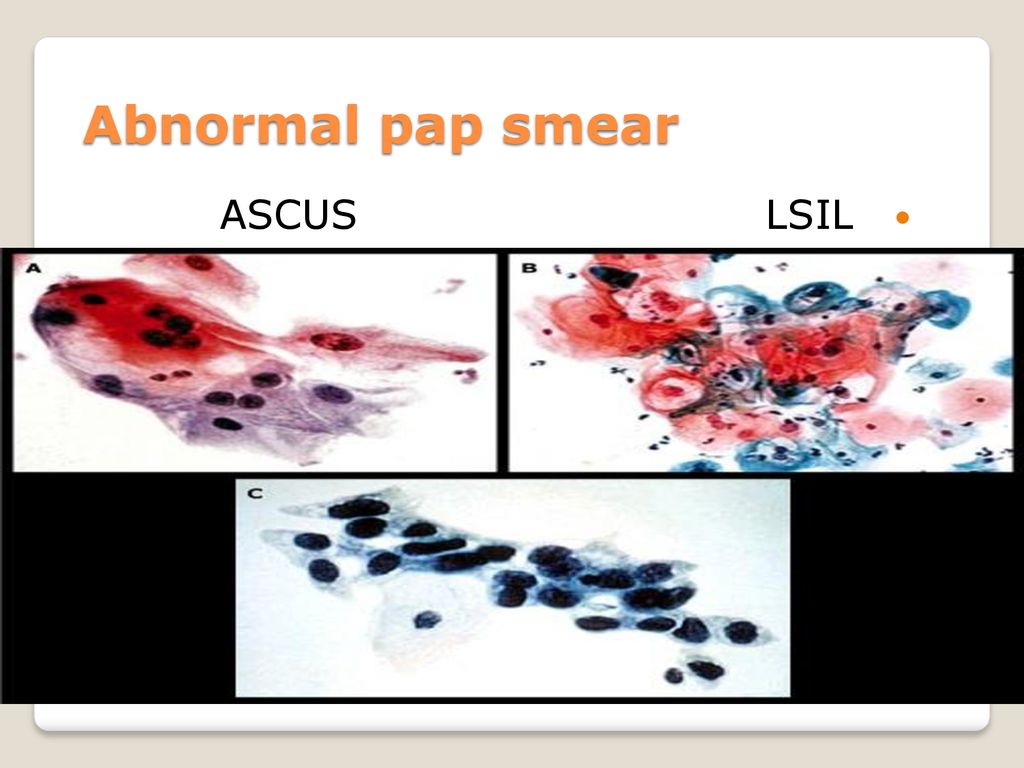 F behnamfar gynecology oncology fellow professor ppt download