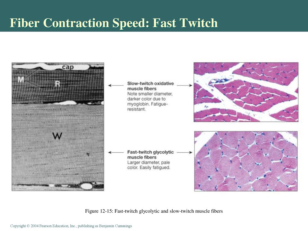 Fiber Contraction Speed: Fast Twitch