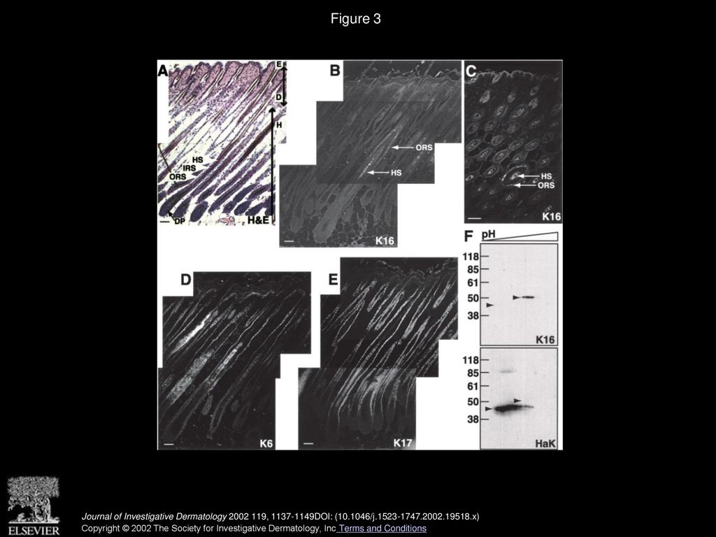 Keratin 16 Expression Defines a Subset of Epithelial Cells During Skin ...