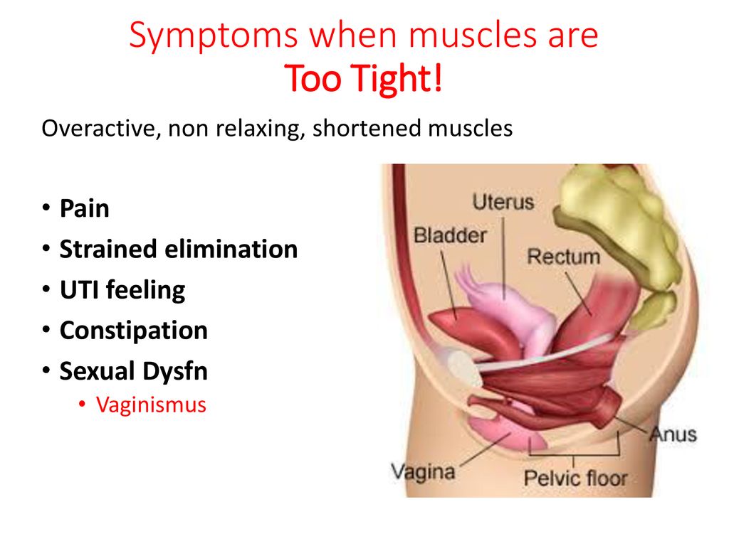 Pelvic Floor Dysfunction Ppt Download