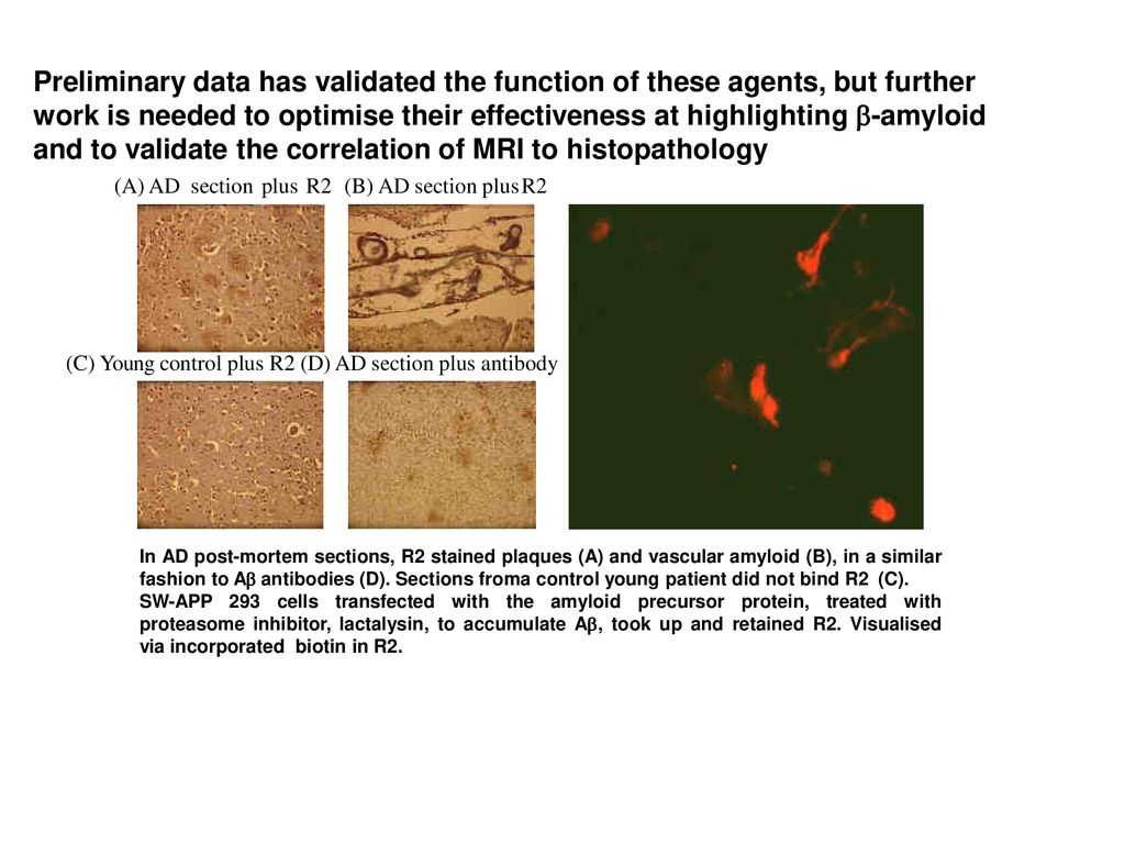 Preliminary data has validated the function of these agents, but further work is needed to optimise their effectiveness at highlighting -amyloid and to validate the correlation of MRI to histopathology