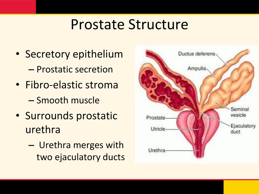 Prostate Embolization: New Treatment Option for BPH - ppt download