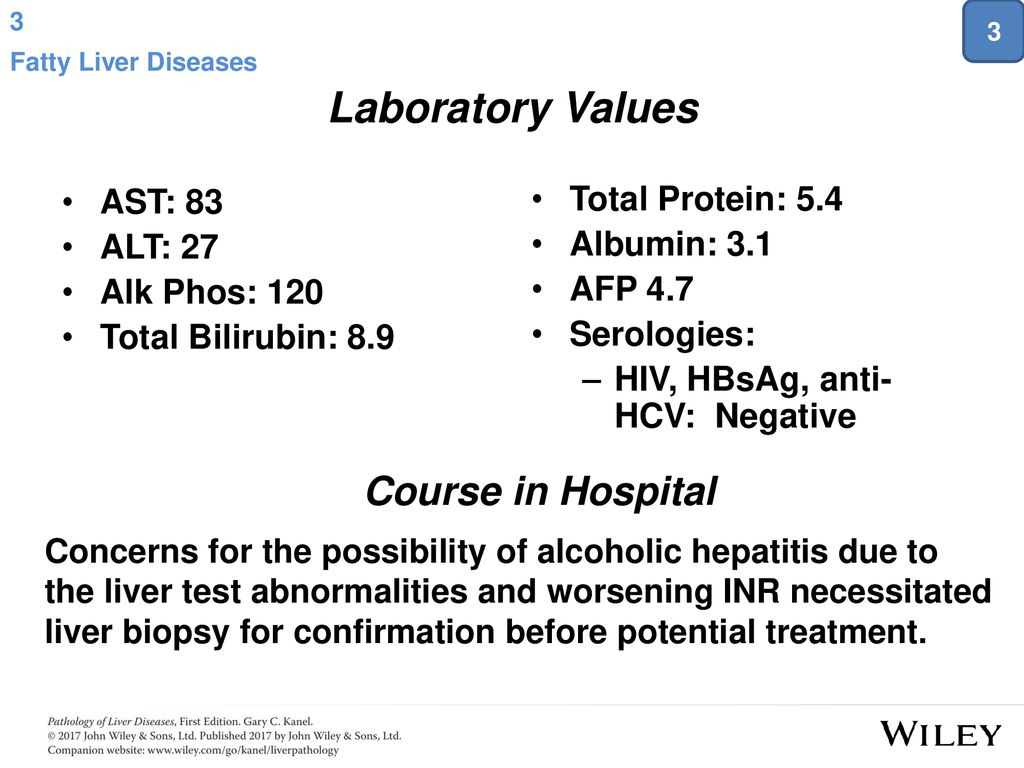 Alcoholic Cirrhosis And Acute Alcoholic Fatty Liver With Cholestasis Ppt Download