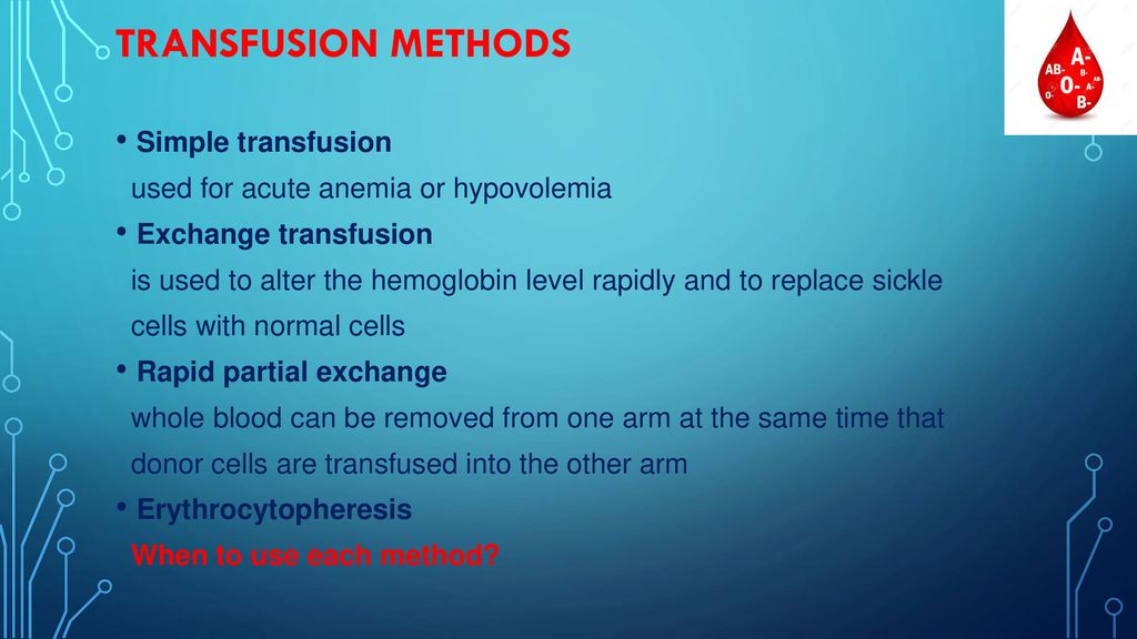 Exchange Transfusion Sickle Cell exchange-transfusion-sickle-cell
