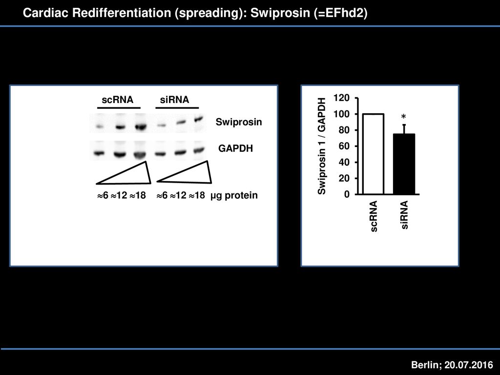 Cardiac Redifferentiation (spreading): Swiprosin (=EFhd2)