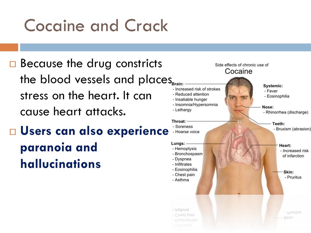 Cocaine and Crack Because the drug constricts the blood vessels and places stress on the heart. It can cause heart attacks.