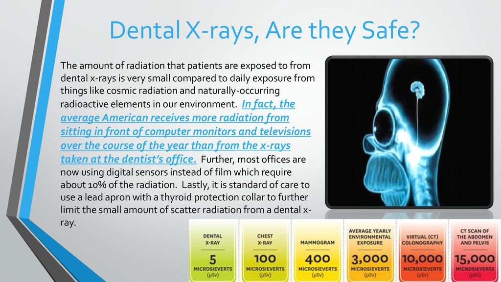 Dental X-rays, Are they Safe