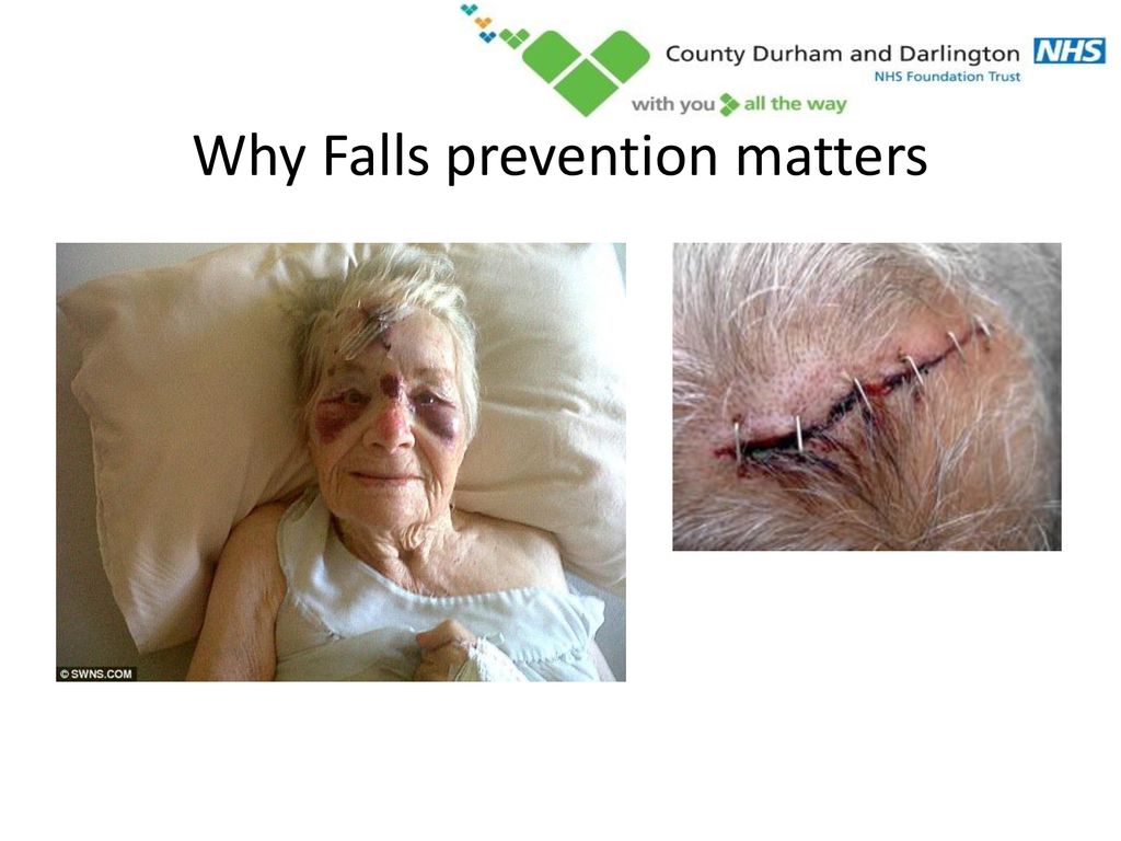 Why Falls prevention matters