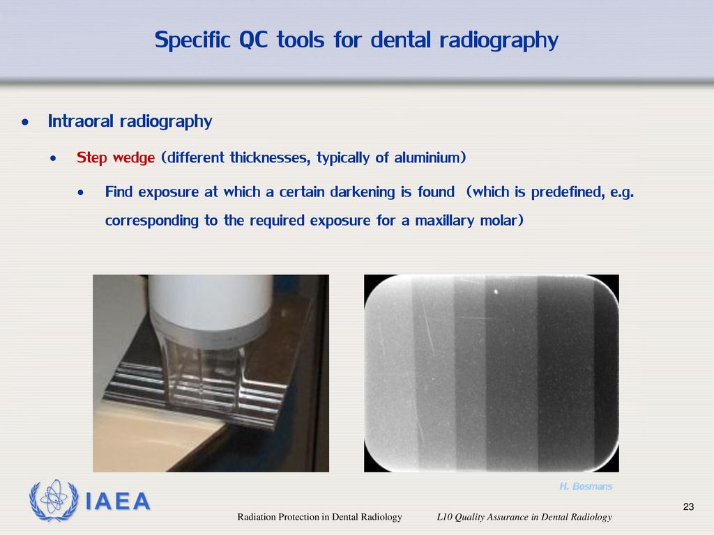 Radiation Protection in Dental Radiology - ppt download