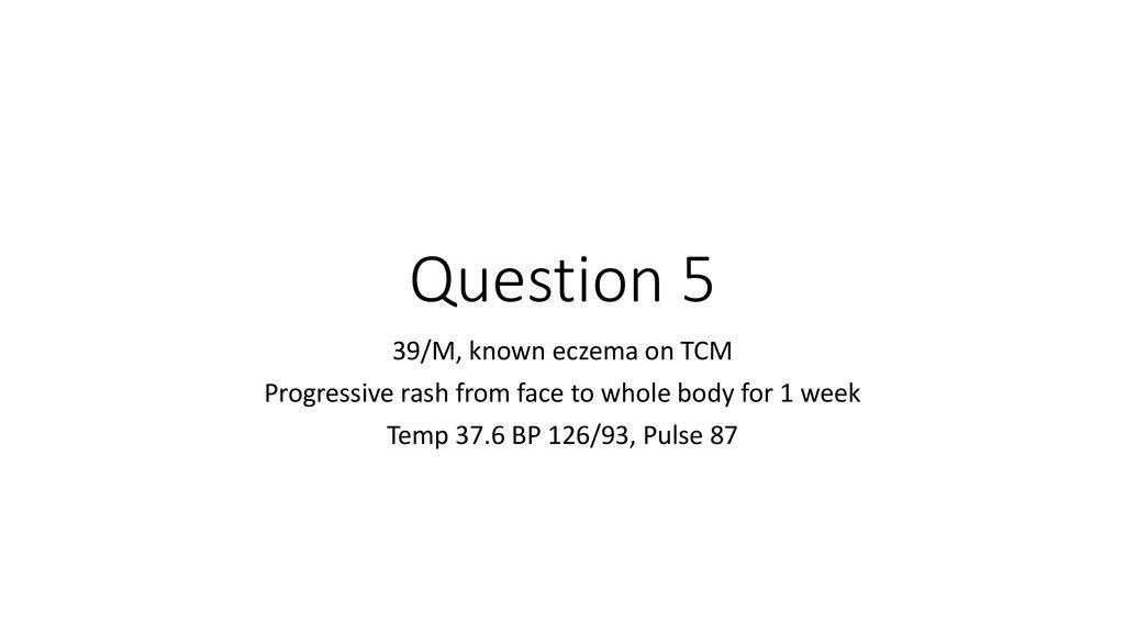 Osce questions 7 3 2018 pwh ppt download