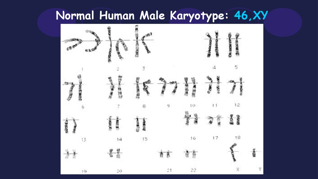 Normal Human Male Karyotype: 46,XY