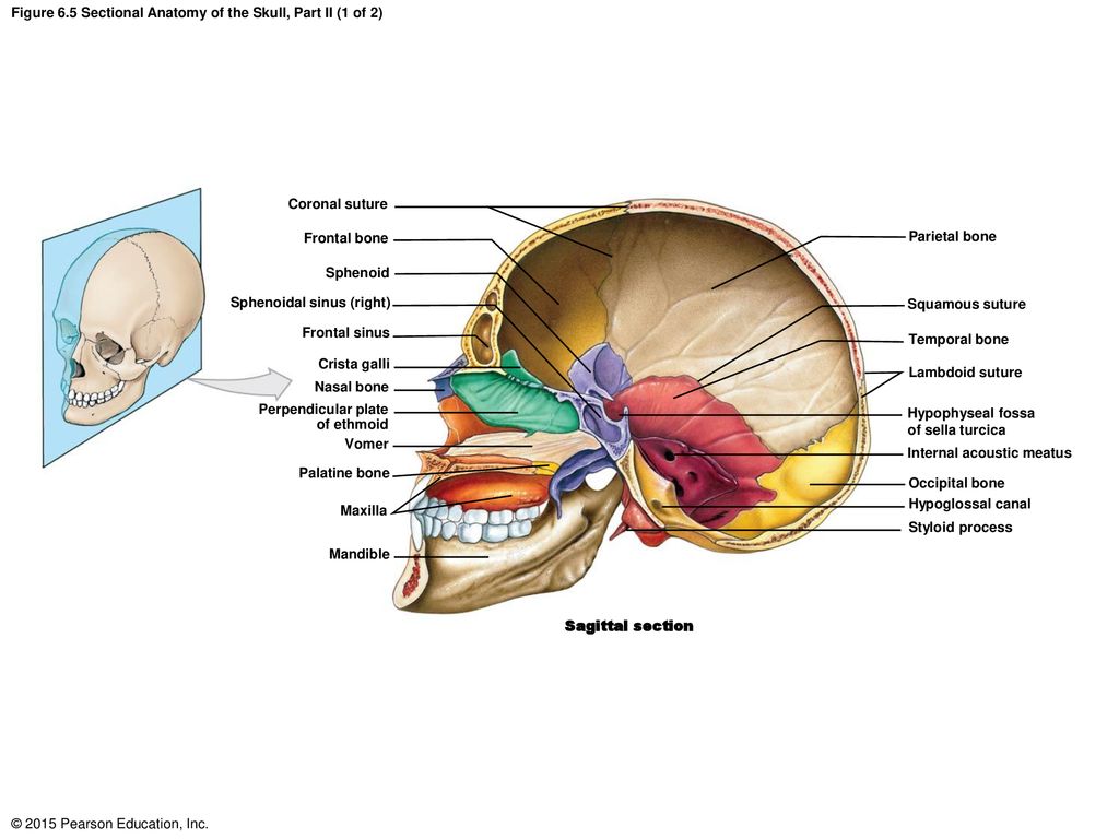 Figure 6.5 Sectional Anatomy of the Skull, Part II (1 of 2)