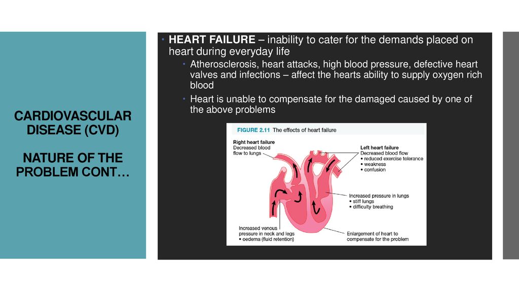 STUDENTS LEARN ABOUT: STUDENT LEARN TO: Cardiovascular disease (CVD ...