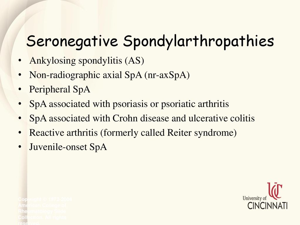 Spondiloartropatiile seronegative | Reumatologie
