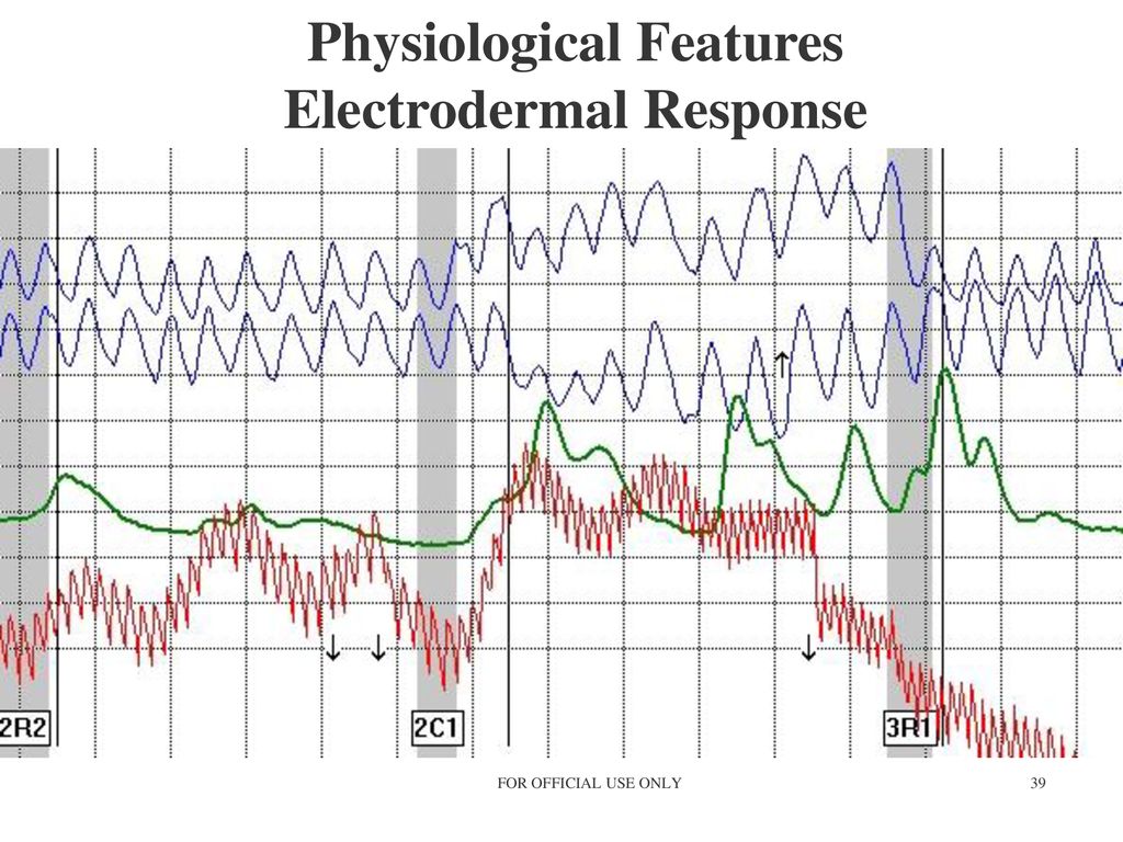 Polygraph Chart Markings