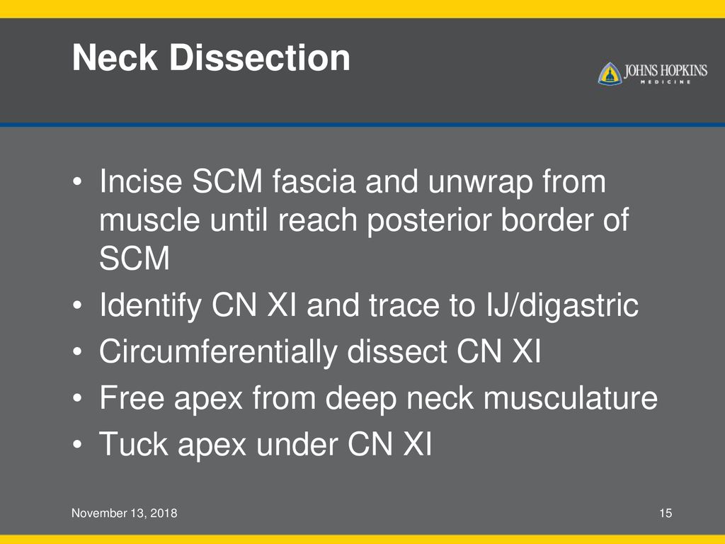 Neck Dissection Incise SCM fascia and unwrap from muscle until reach posterior border of SCM. Identify CN XI and trace to IJ/digastric.