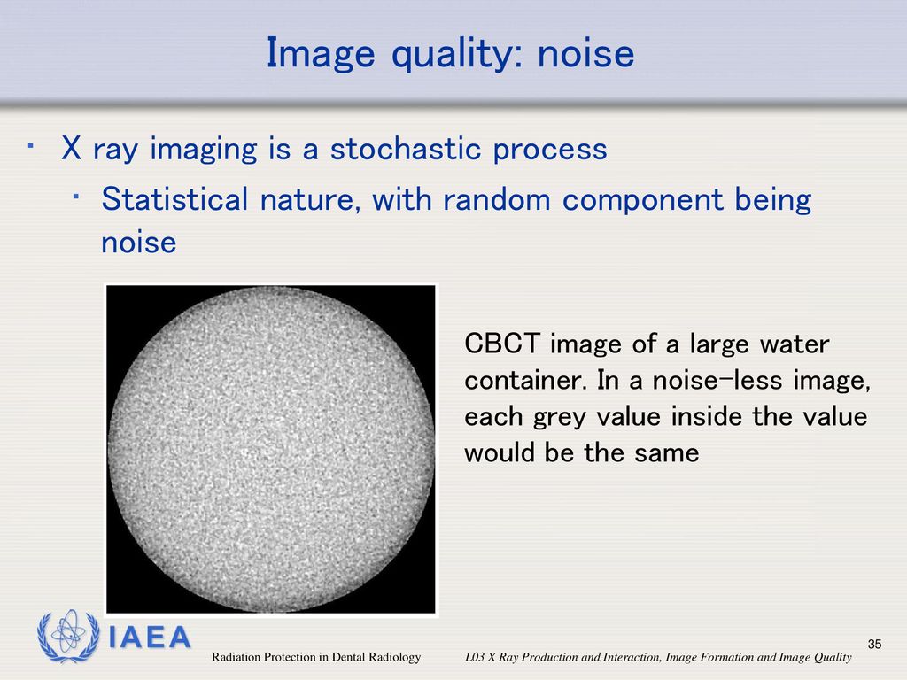 Image quality: noise X ray imaging is a stochastic process