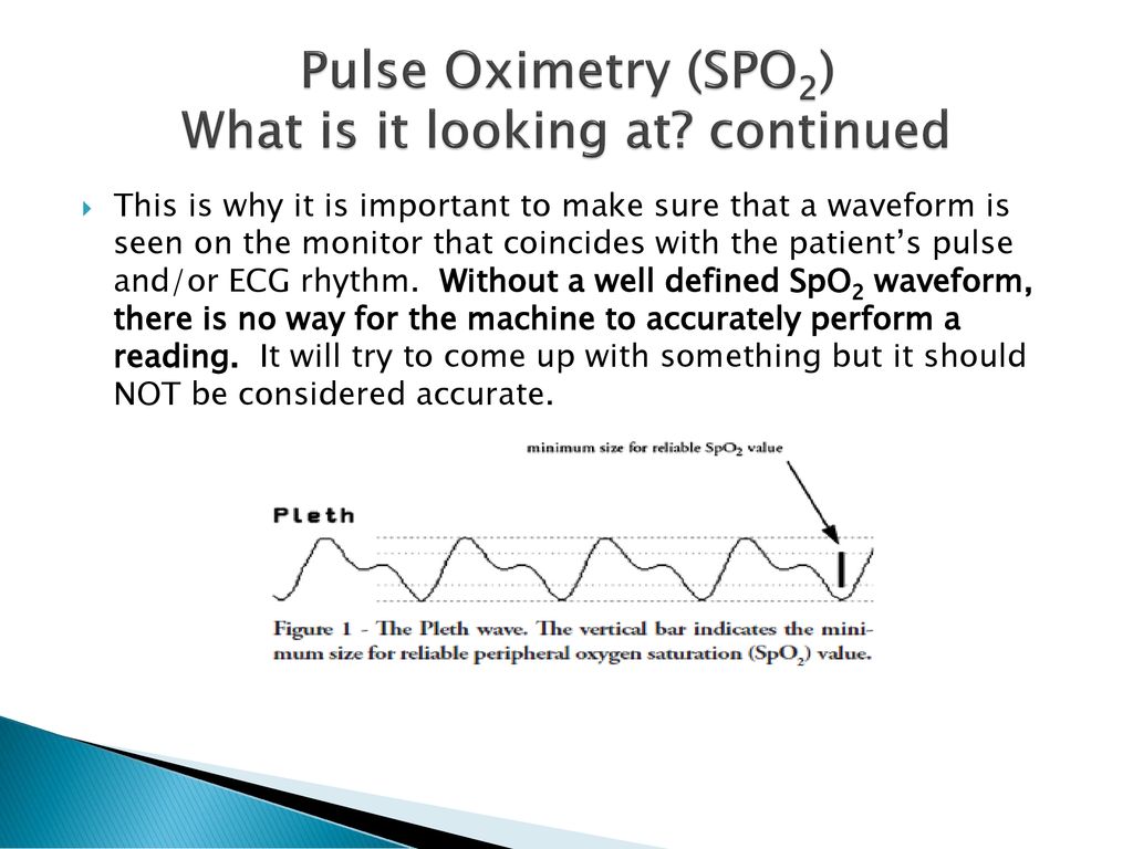 What's in a Waveform Pulse Oximetry Capnography - ppt download