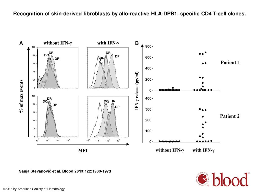 Recognition of skin-derived fibroblasts by allo-reactive HLA-DPB1–specific CD4 T-cell clones.