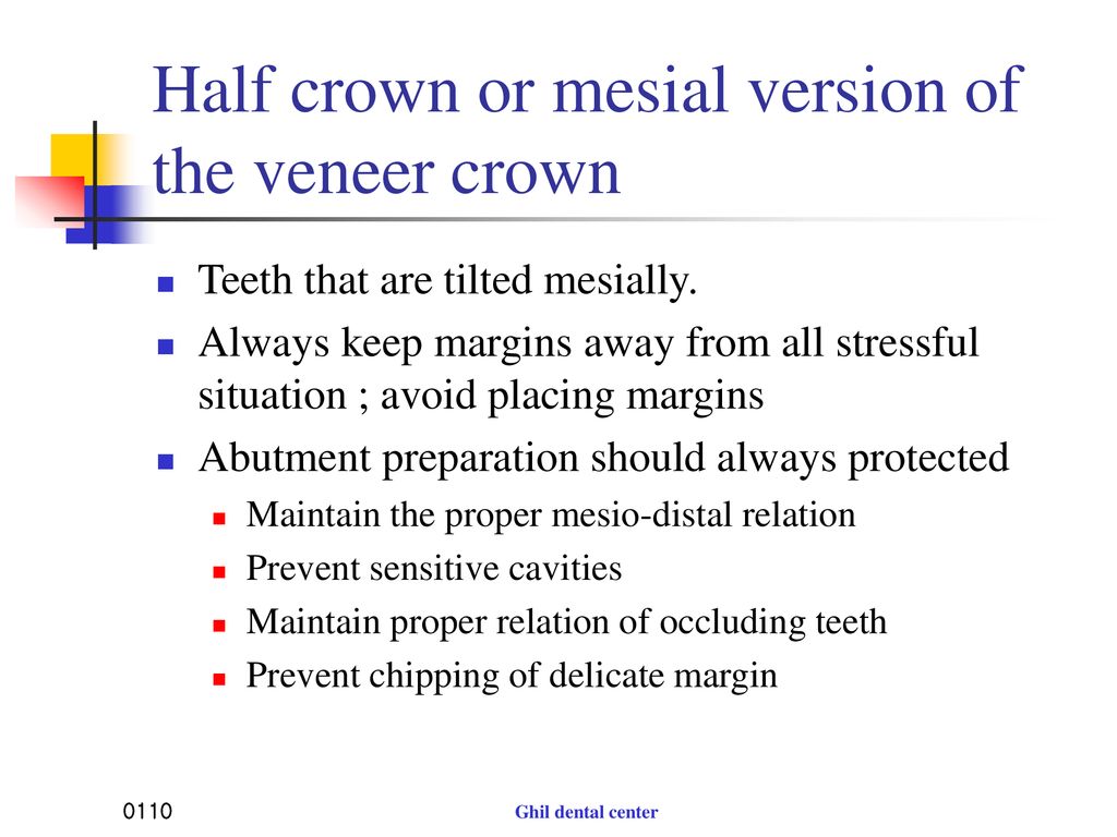 Half crown or mesial version of the veneer crown