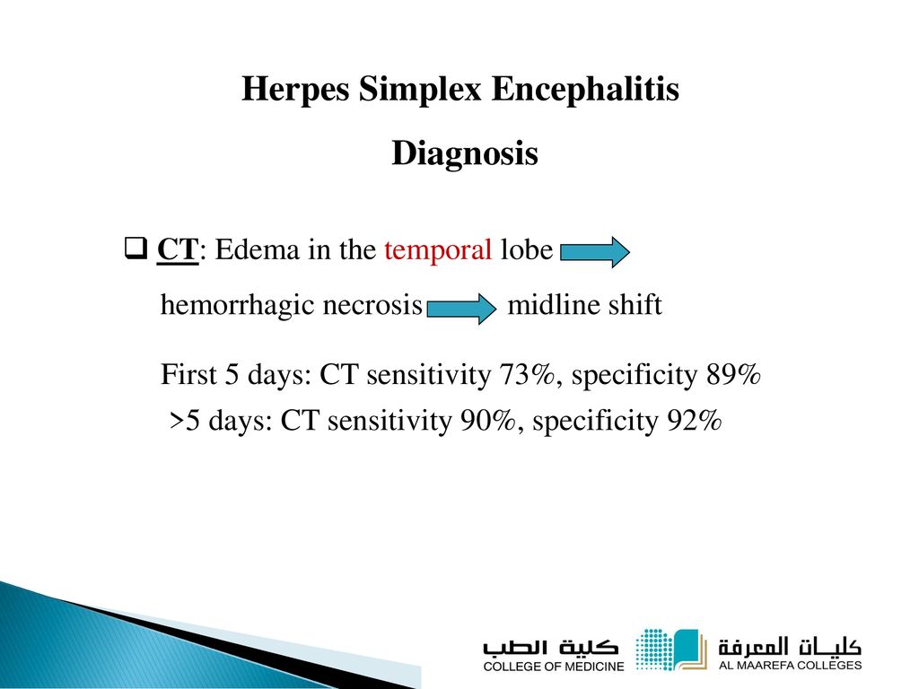 Herpes Simplex Encephalitis