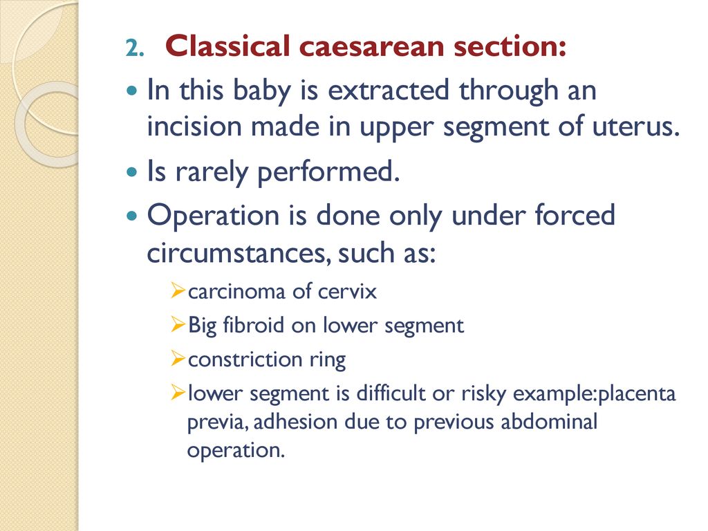 Caesarean section ppt download