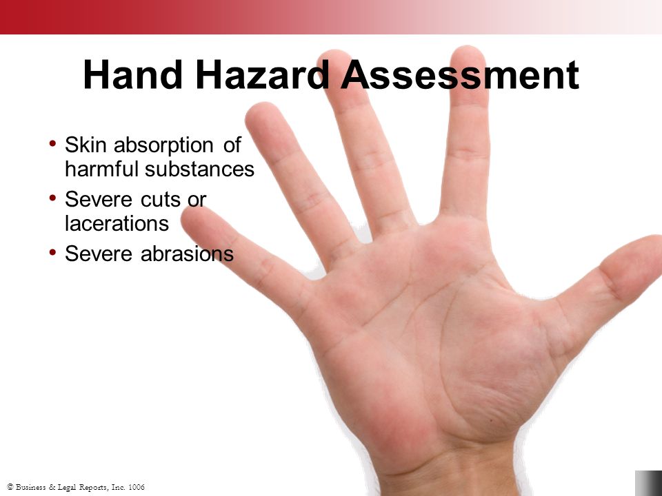 Hand Hazard Assessment