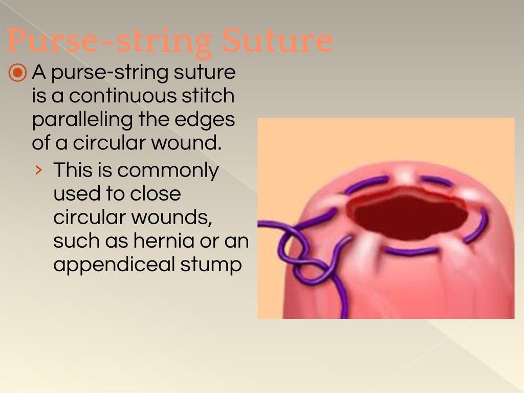 Forceps for pursestring suture | KARL STORZ Endoskope | Norway