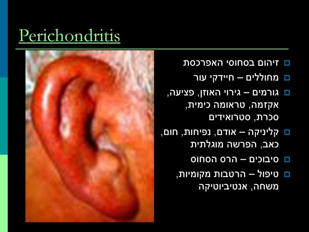 אוזן חיצונית External ear - ppt download