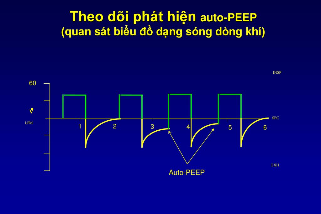 Theo dõi phát hiện auto-PEEP (quan sát biểu đồ dạng sóng dòng khí)