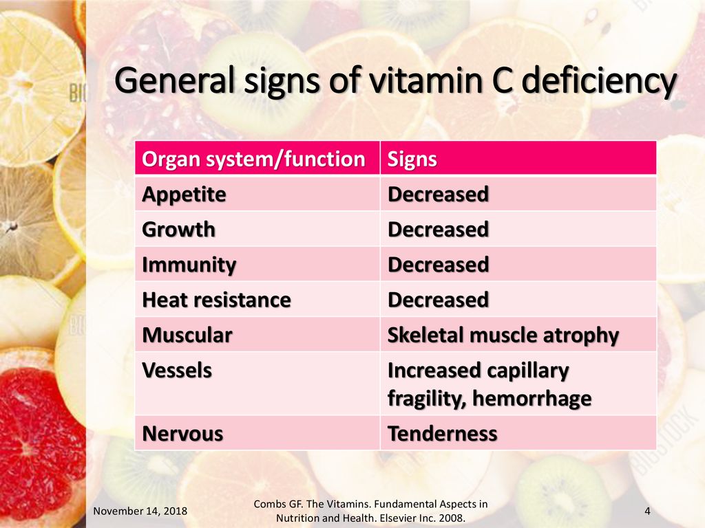 Vitamin C deficiency Domina Petric, MD. - ppt download