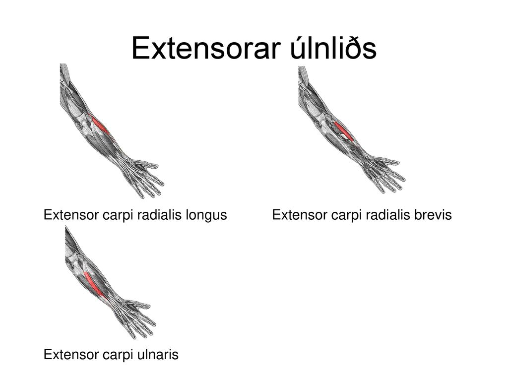Extensorar úlnliðs Extensor carpi radialis longus
