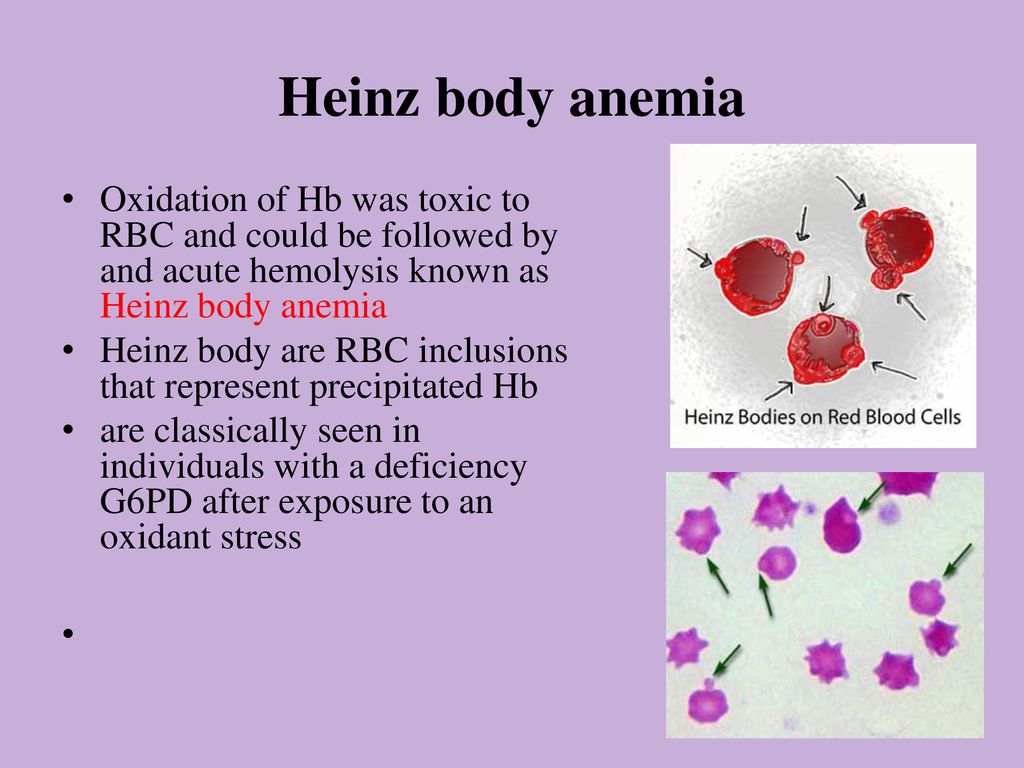 Occupational Hematology - ppt download